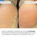 Набір для загоєння та м'якості п'ят Hillary - 2