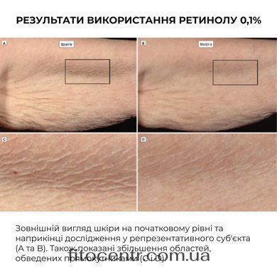 Комплекс Hillary ночного восстановления кожи лица с ретинолом и пептидами - 10
