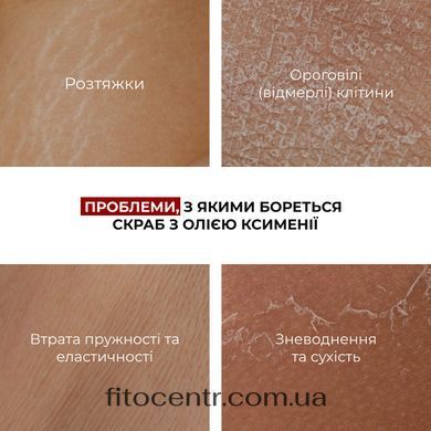 Краб с маслом ксимении для предупреждения появления растяжек Hillary, 200 г - 5