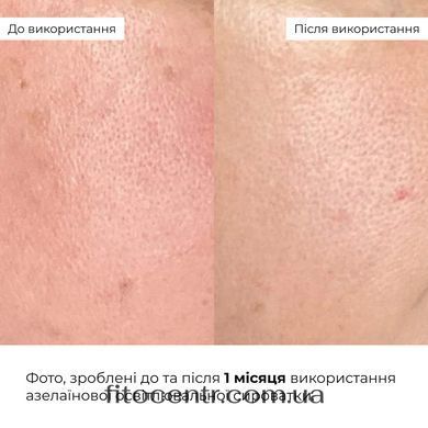 Набор против тусклости, постакне и пигментации Hillary - 8