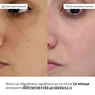Hillary Set Against Dull Skin and Dry Lips