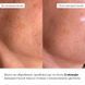 Hillary Set Against Dull Skin and Dry Lips