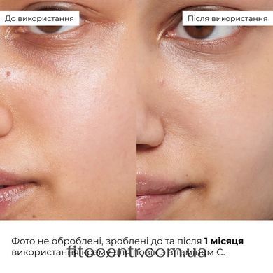 Hillary Vitamin C Radiance & Even Tone Kit with Collagen Granola Gregory Mill