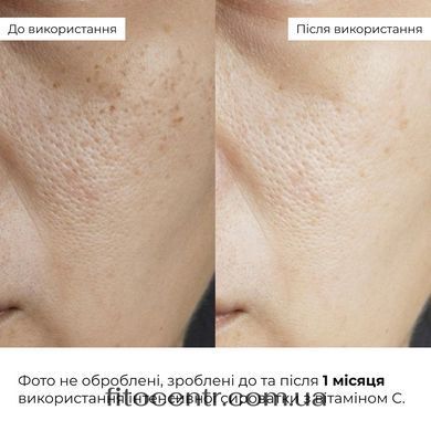 Hillary Vitamin C Radiance & Even Tone Kit with Collagen Granola Gregory Mill