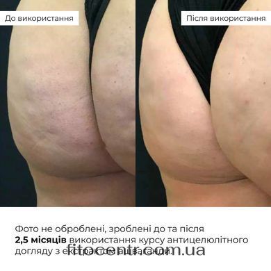 Курс Hillary антицеллюлитного ухода в домашних условиях с экстрактом ашваганды - 4