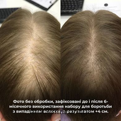 Hair serum Concentrate Serenoa + Shampoo for all hair types Nori Micellar and comb Hillary