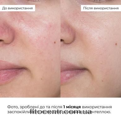 Комплекс Hillary для борьбы с отеками и тусклостью кожи - 10