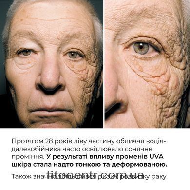 Комплекс Hillary для очищения, себорегуляции и защиты кожи SPF 30 - 11