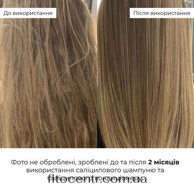 Salicylic Hair Reset Conditioner for hair restoration Hillary Salicylic Hair Reset Conditioner, 400 ml