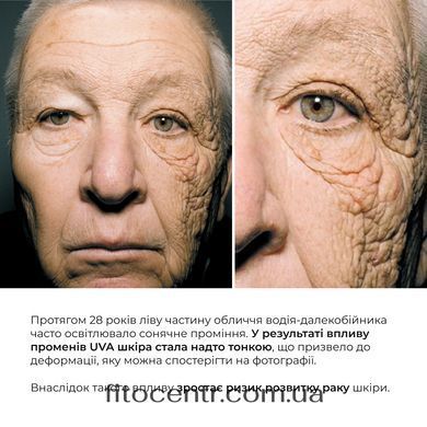 Сонцезахисна сироватка SPF 30 з вітаміном С + Базовий набір Hillary для догляду за шкірою обличчя сухого типу - 24