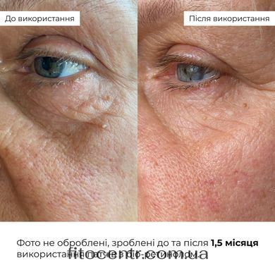 Refreshing and smoothing eye patches Hillary Bacuchiol Wrinkle Correcting & Vitamin C Refreshing