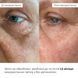 Refreshing and smoothing eye patches Hillary Bacuchiol Wrinkle Correcting & Vitamin C Refreshing