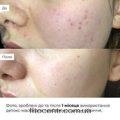 Hillary Clay Detox & Anti-Puffiness Complex
