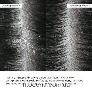 Enzyme peeling for the scalp + Set for dry hair type Hillary Aloe Deep Moisturizing