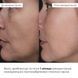 Hillary Clay Detox & Anti-Puffiness Complex
