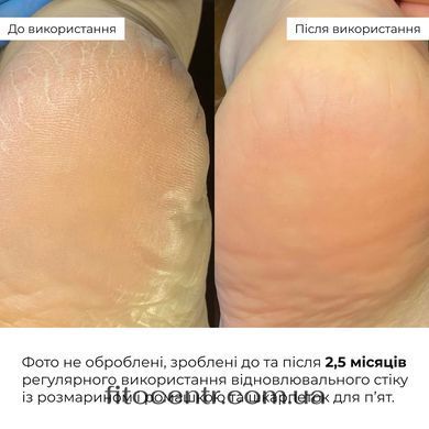 Repair Heel Socks Hillary Repair HydraHeel Comfort Socks