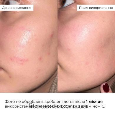 Hillary Daily Hydration & Even Skin Tone Complex