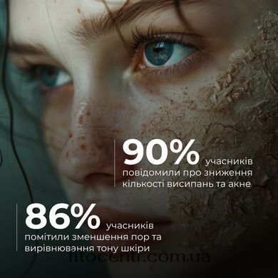 Комплекс Hillary глиняных масок для детоксикации и восстановления упругости кожи - 3