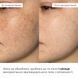 Hillary Daily Hydration & Even Skin Tone Complex